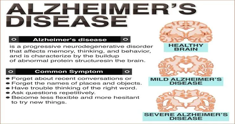 Early stage Alzheimer’s problems, any advice?