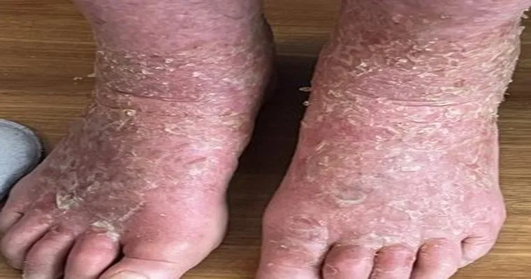 My mom is in a rehabilitation setting for Edema in her legs. I expressed valid concerns regarding known retaliation against my mom, what can I do?