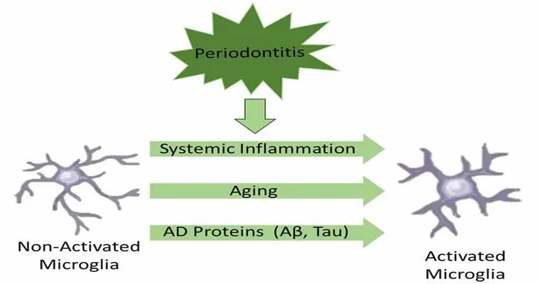 Have you been reading the articles about gum disease and dementia?