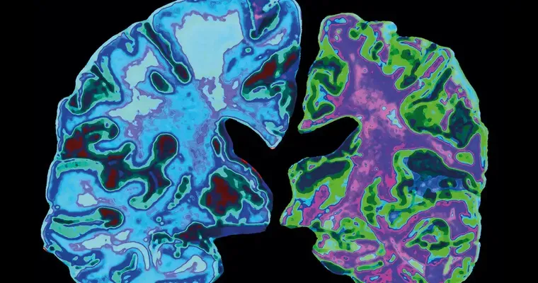 Are Advanced Alzheimer's Patients Aware of Their Surroundings?