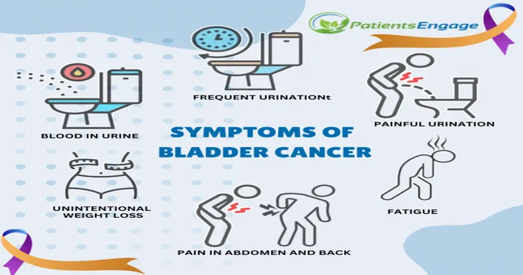 Bladder Cancer: Signs, Symptoms and Treatments