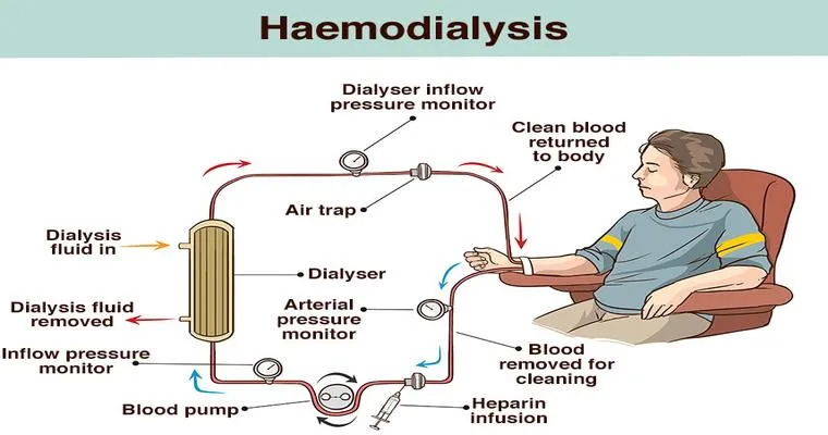 How to deal with dialysis?