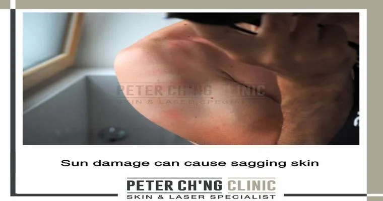 What causes severe muscle loss and skin to be flabby?