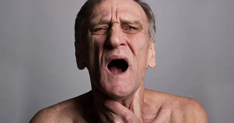 Why Do Alzheimer's Patients Forget How to Eat or Swallow?