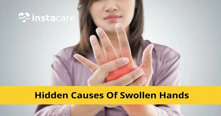 What is causing severe edema in my Mom’s arms and hands?