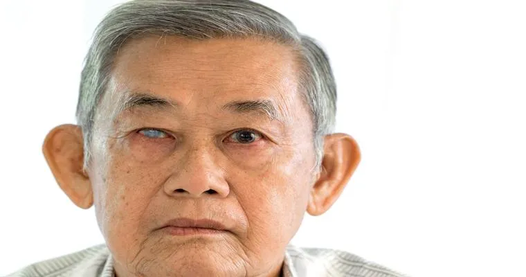 What is Glaucoma and Why Does it Affect the Elderly?
