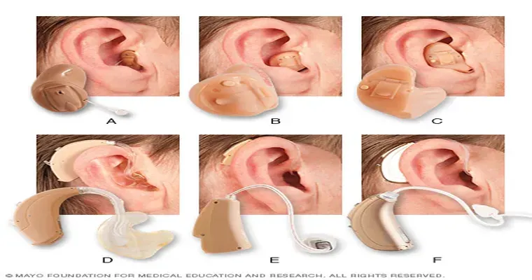 Still losing hearing aids.