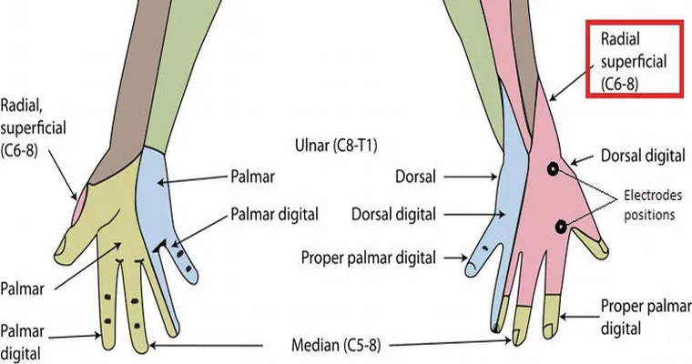 Anybody dealing with "Atypical Parkinson's"? No tremors but weak/meek voice, slow chewing, poor taste, slow arm movements, incontinence.