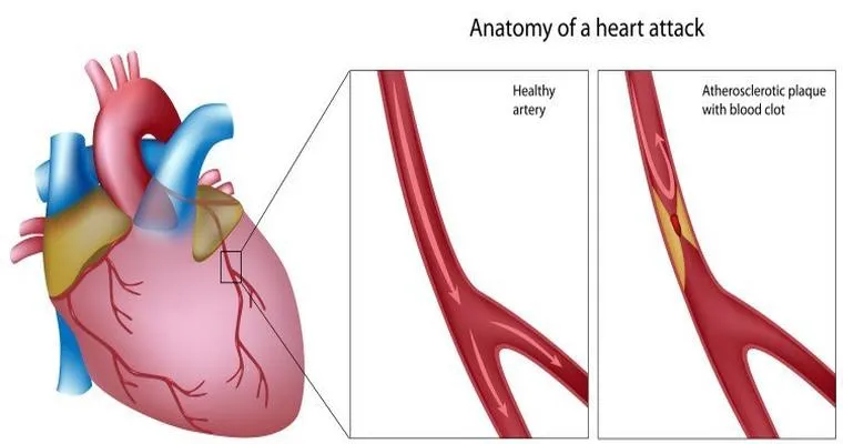 What to do? Dad had angiogram on right leg, 1 month later got him home, same thing starting on left leg, where to go from here?