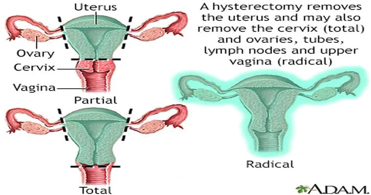 Bleeding after many years of hysterectomy. Is this normal?