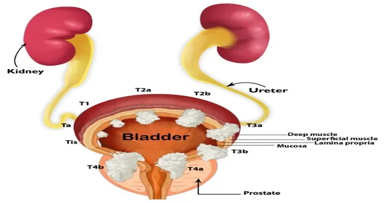 My dad is in end stage bladder cancer and wants to come to Buffalo. I need suggestions for medical transport.