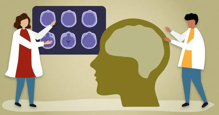What Doctors Diagnose Alzheimer's Disease?