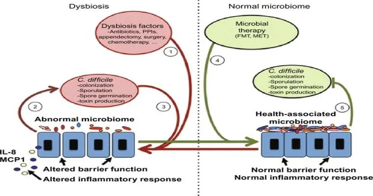 C-diff experimental treatment