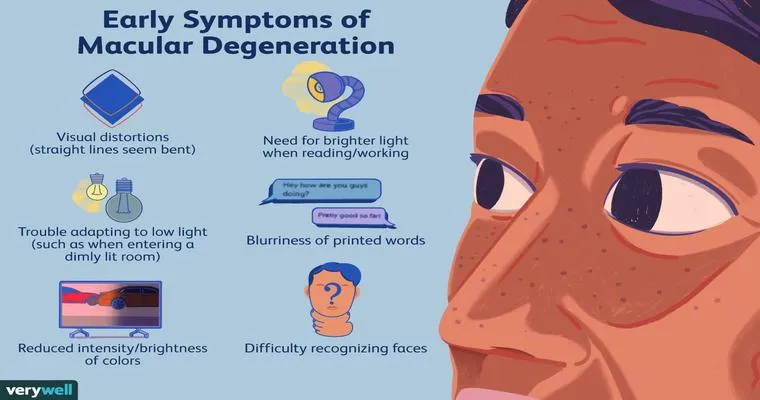 Does anyone else care for someone going blind from Macular Degeneration? Any advice you can give?
