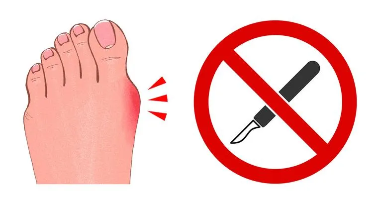 My Husband had the foot surgery. I came to visit him. He says to me it doesn’t look good. It is not healing.