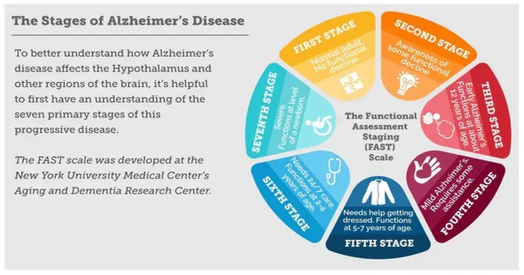 Are there estimates of the average time between stages of dementia?