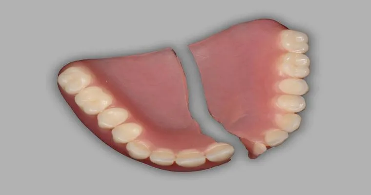 Broken denture, now what?