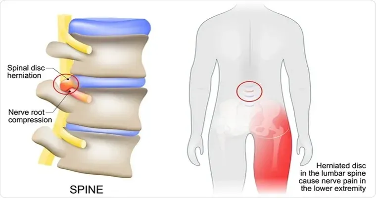 Placing central line in the groin for an advanced dementia loved one, does this procedure hurt?